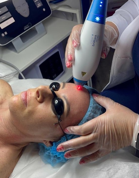 clear brilliant laser treatment yamilas faces skin care hallandale